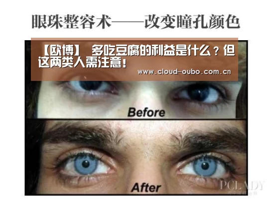 【欧博】
多吃豆腐的利益是什么?但这两类人需注意!(图2) 欧博游戏